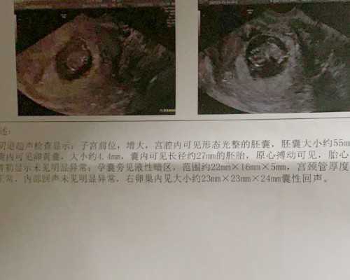 国内私立的供卵机构排名,最后的肖像（关于最后的肖像介绍）