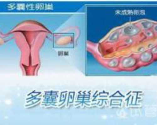 经常做这三种梦后不能轻易告诉别人,当心害人害已 供卵代怀孩子机构